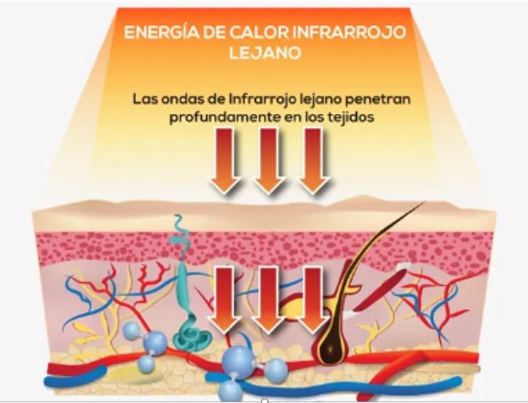 INRARROJO